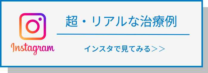 超・リアルな治療例 インスタで見てみる