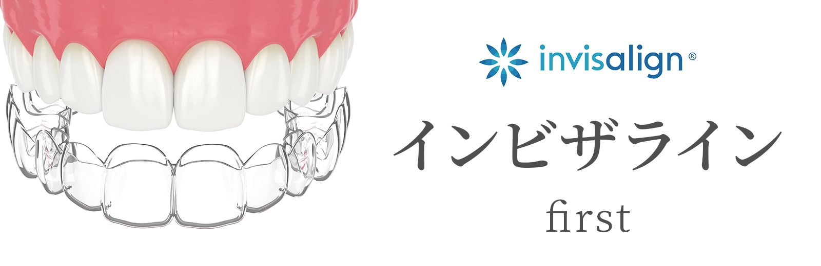 インビザライン・ファースト